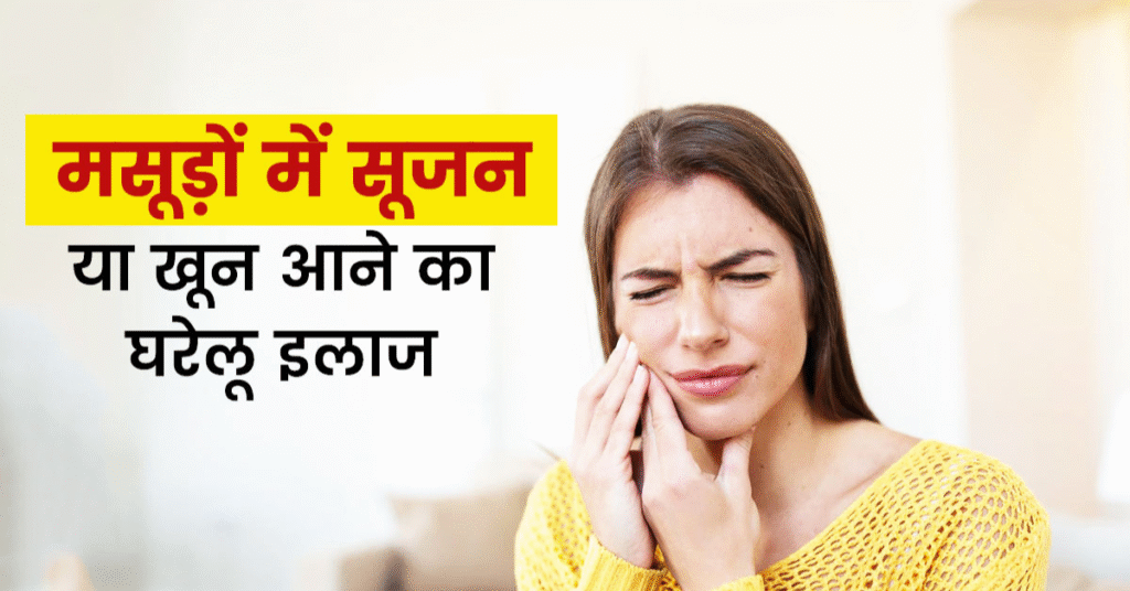 मसूड़ों की सूजन की दवा और घरेलू इलाज