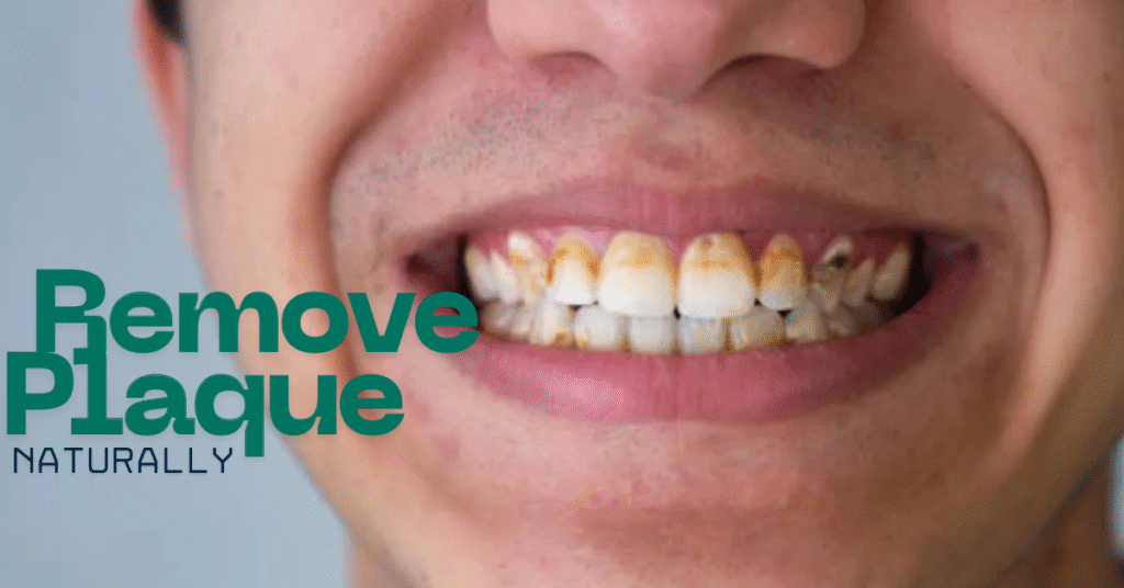 दांतों पर प्लाक क्या है और इसे कैसे हटाएं? Remove Plaque Naturally