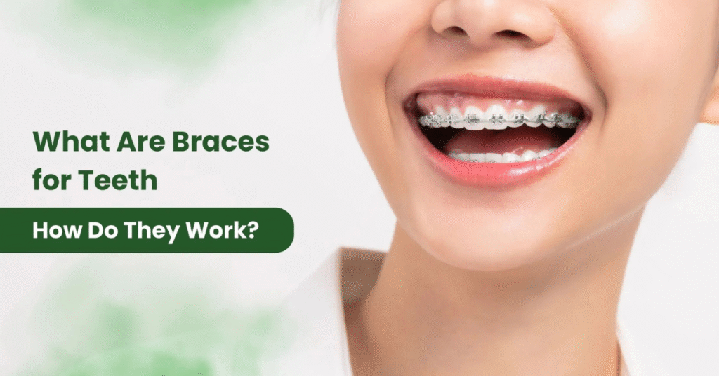 टेढ़े-मेढ़े दांत ठीक करने के आधुनिक तरीके और खर्च