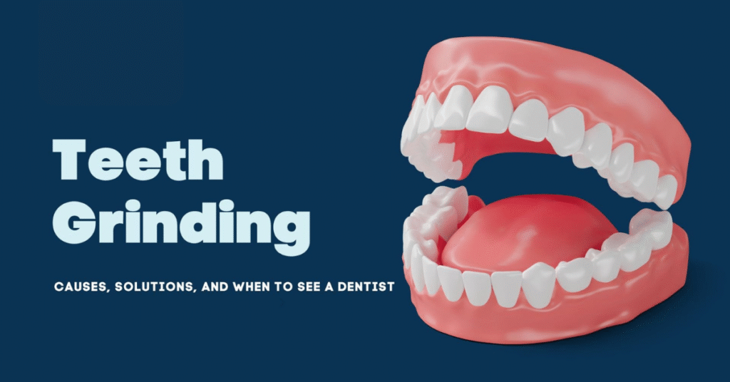 रात में दांत पीसना (Teeth Grinding) क्यों होता है और कैसे रोके?