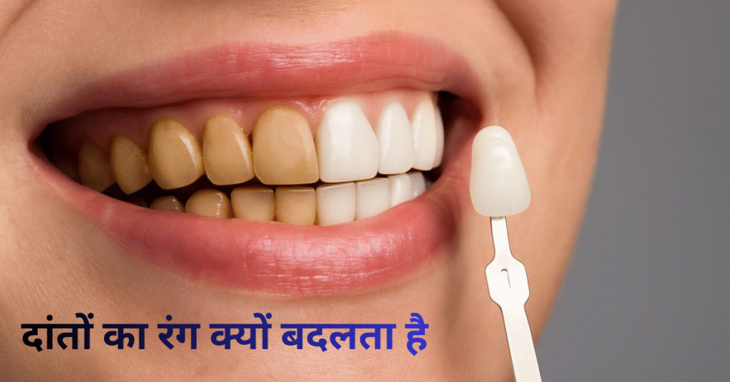 दांतों का रंग क्यों बदलता है? 8 Scientific कारण (पूरी गाइड)
